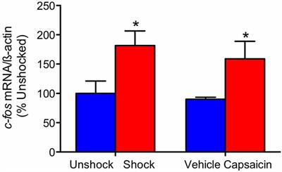 Pain Input After Spinal Cord Injury (SCI) Undermines Long-Term Recovery and Engages Signal Pathways That Promote Cell Death
